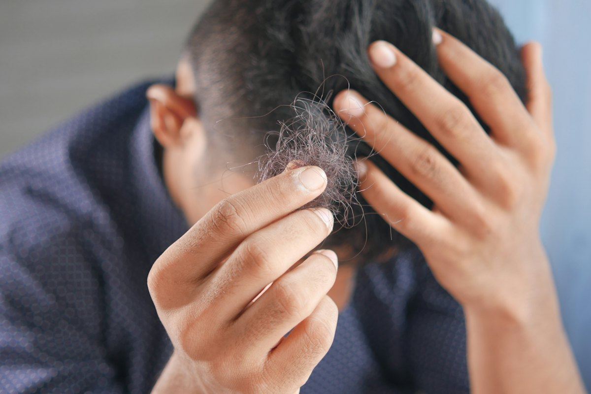Why Dandruff Gets Worse in Winter, and How a Salon Treatment Fixes It